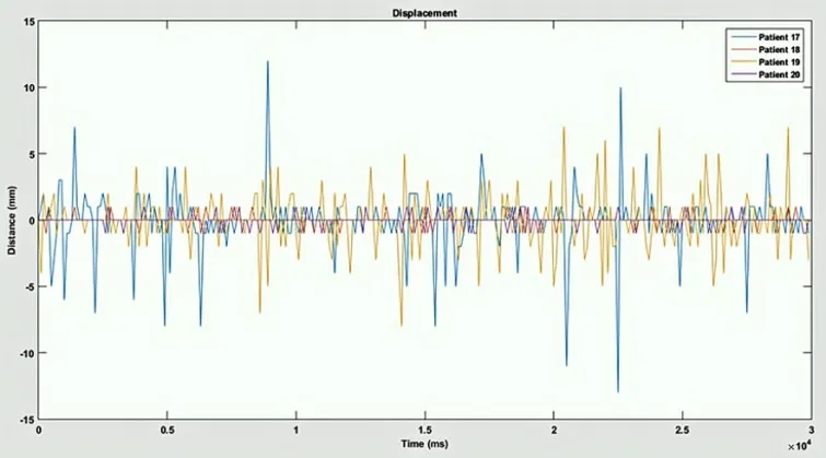 Vital-sign signals tracked over time for several monitored subjects